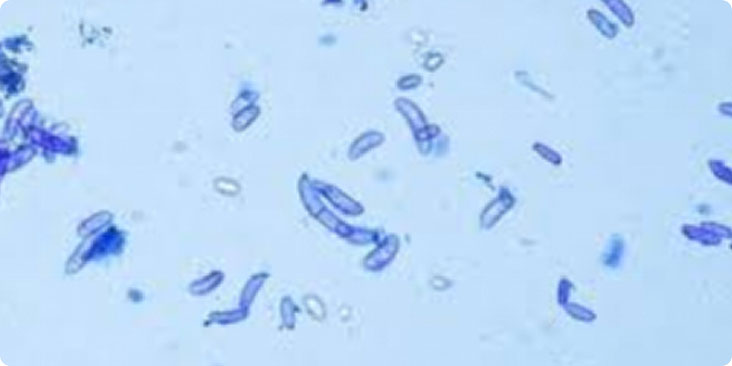 Microbial Contamination Risk